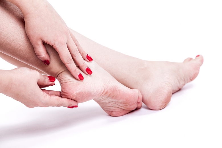 Spina calcaneare: come risolverla? Spina calcaneare: come risolverla?
