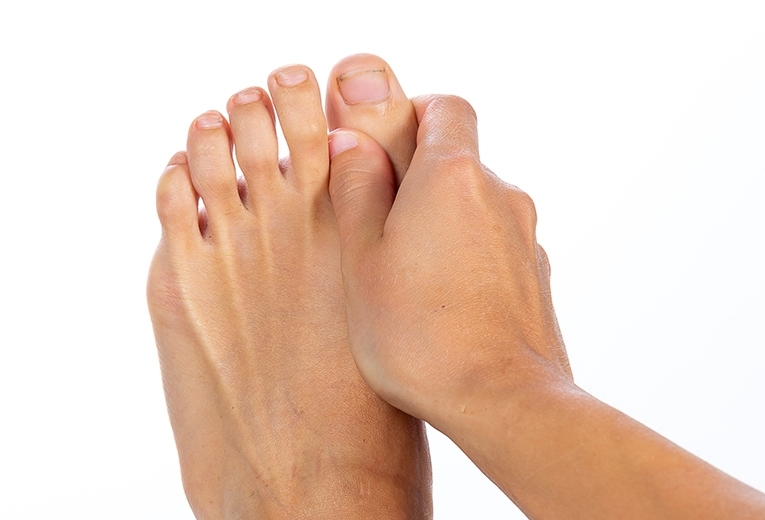 Dolore all'alluce: da cosa dipende? Dolore all'alluce: da cosa dipende?