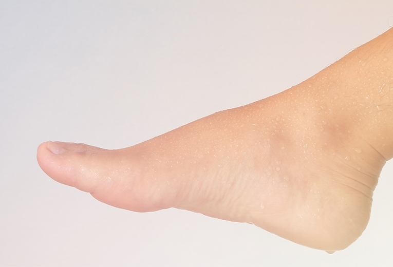 Piedi sudati: perché i miei piedi sudano tanto? Piedi sudati: perché i miei piedi sudano tanto?